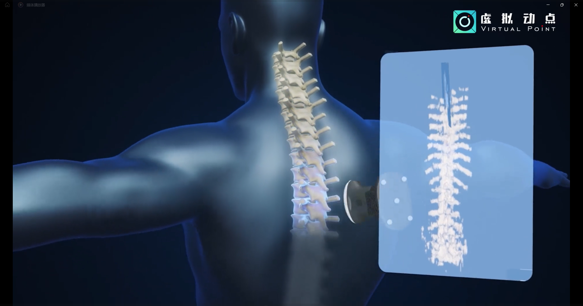 xkty.com星空·虚拟动点OptiTrack开创3D超声成像在脊柱诊断中的应用